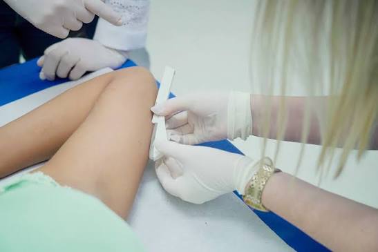 Anvisa amplia prazo de eficácia do implante anticoncepcional Implanon