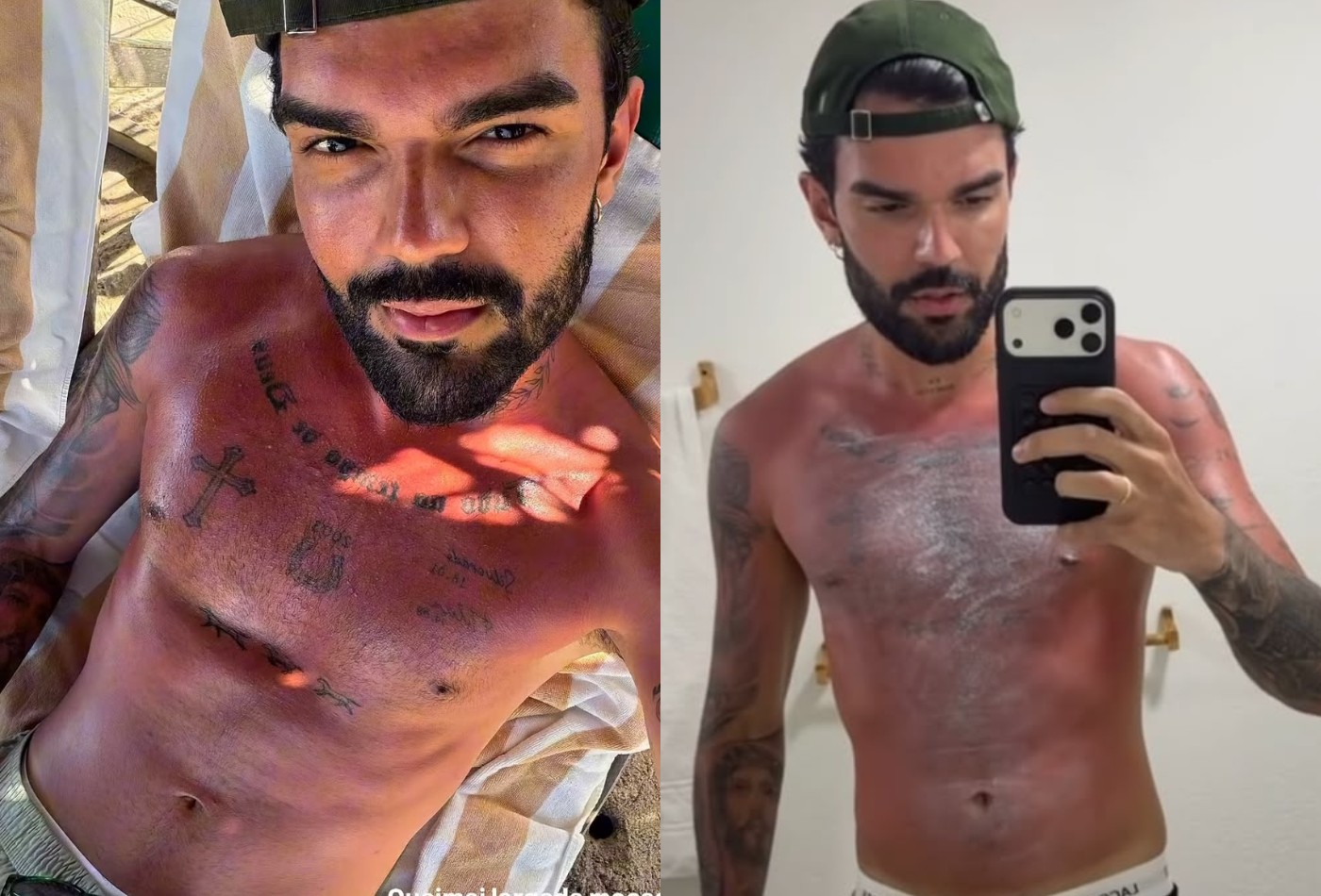 Luan Pereira sofre insolação durante viagem de férias em Alagoas