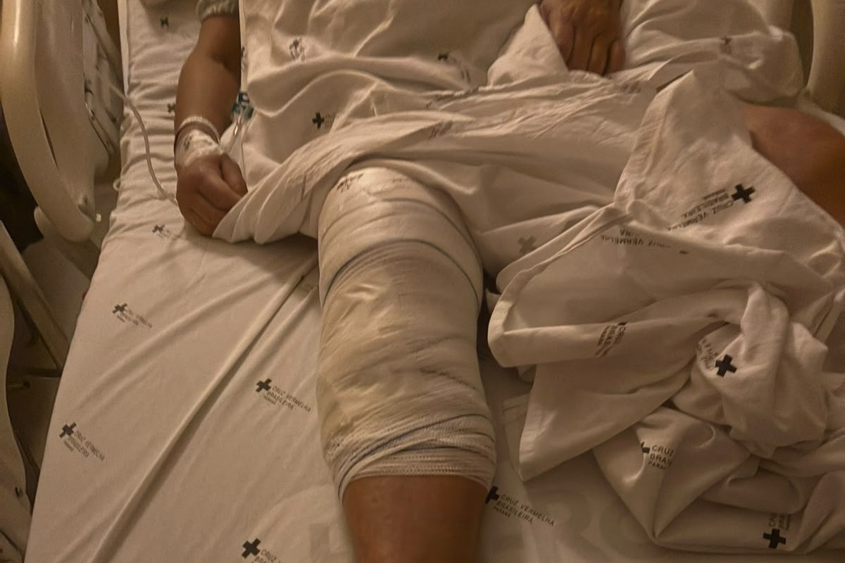 Idosa de 72 anos passa por cirurgia e recebe prótese no joelho errado
