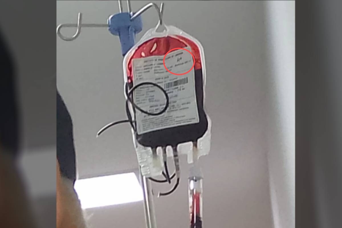 Paciente sofre reação após transfusão de sangue em hospital do Paraná