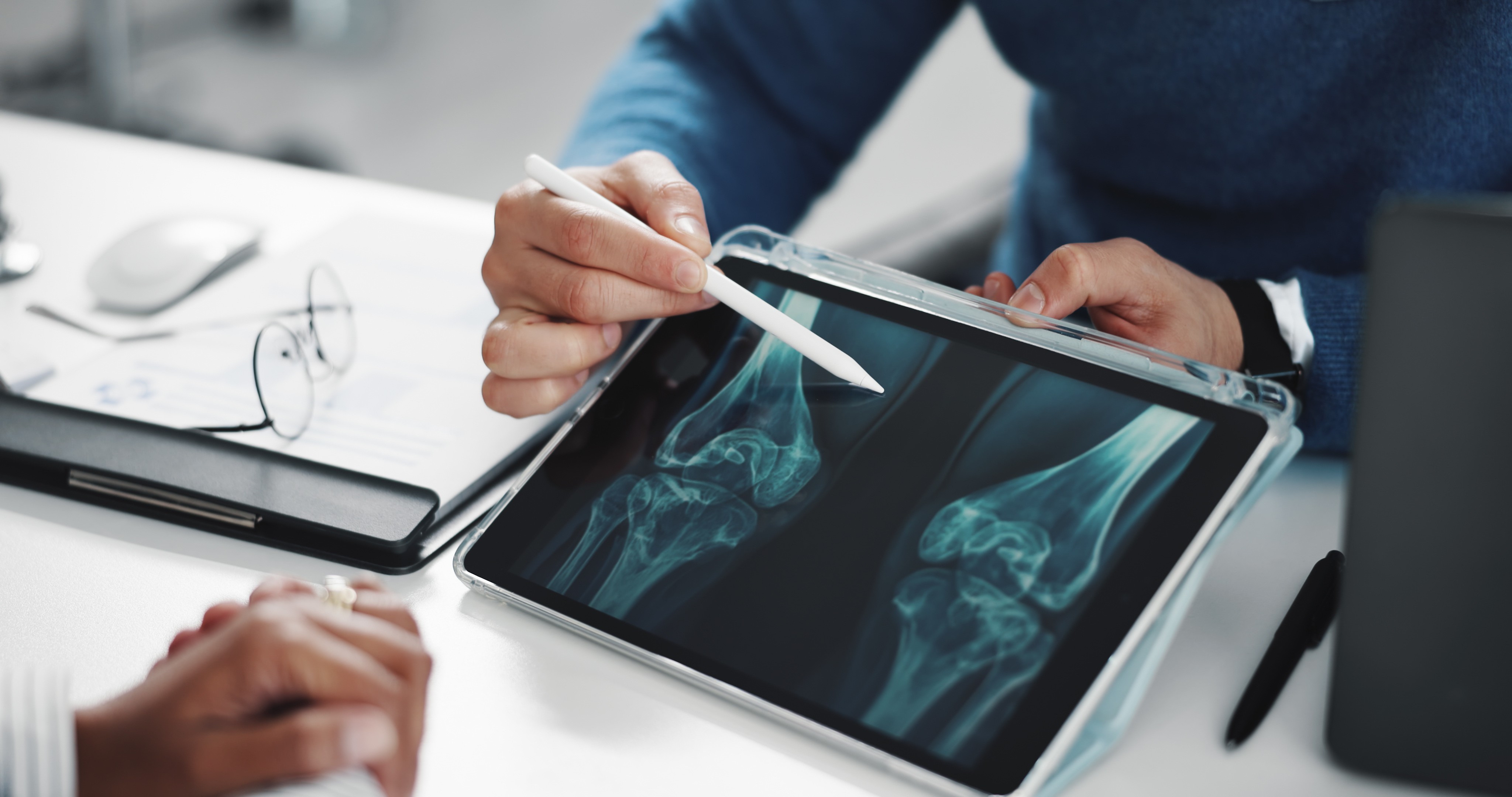Osteoporose: entenda fatores de risco e saiba como prevenir